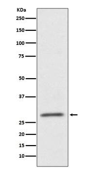 CD99 Rabbit Monoclonal Antibody