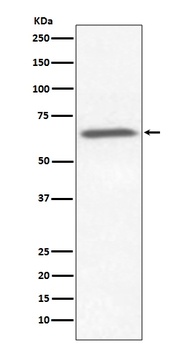 Anti-Ku70 XRCC6 Rabbit Monoclonal Antibody