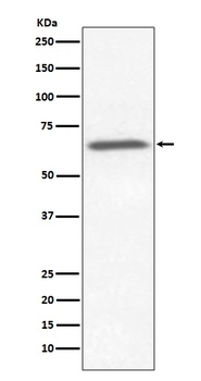 Ku70 XRCC6 Rabbit Monoclonal Antibody