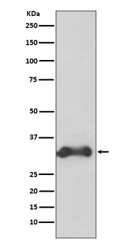 Cyclin D3 CCND3 Rabbit Monoclonal Antibody
