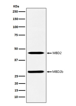 MBD2 Rabbit Monoclonal Antibody