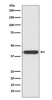 HDAC8/Histone Deacetylase 8 Rabbit Monoclonal Antibody