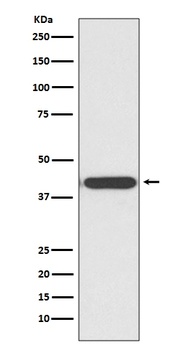 Anti-HDAC8/Histone Deacetylase 8 Rabbit Monoclonal Antibody