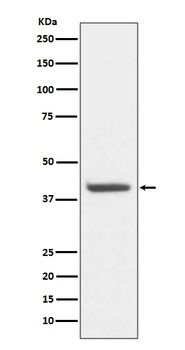 Anti-HDAC8/Histone Deacetylase 8 Rabbit Monoclonal Antibody