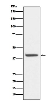 HDAC8/Histone Deacetylase 8 Rabbit Monoclonal Antibody