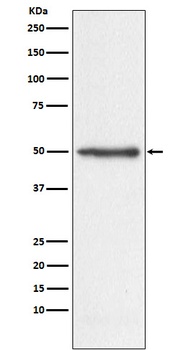 Anti-Nogo Monoclonal Antibody