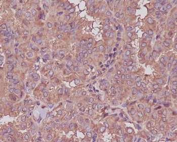 Anti-beta III Tubulin TUBB3 Rabbit Monoclonal Antibody