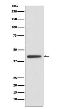 Anti-ADIPOR1 Rabbit Monoclonal Antibody