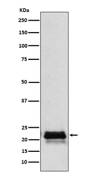 Anti-FSH beta (FSHB) Monoclonal Antibody