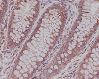 Anti-Rab5 RAB5A Rabbit Monoclonal Antibody