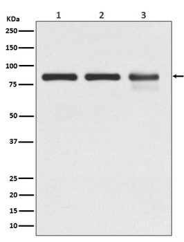 Catenin gamma JUP Rabbit Monoclonal Antibody
