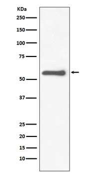 Anti-Tyrosine Hydroxylase TH Rabbit Monoclonal Antibody