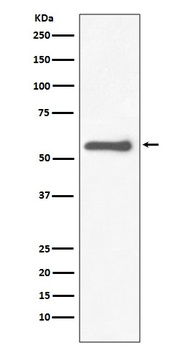 Tyrosine Hydroxylase TH Rabbit Monoclonal Antibody