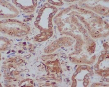 Tyrosine Hydroxylase TH Rabbit Monoclonal Antibody