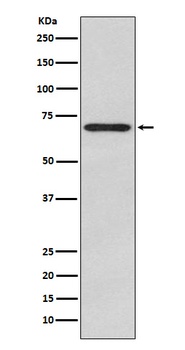 Anti-Glypican 3 Monoclonal Antibody