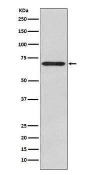 Glypican 3 Monoclonal Antibody