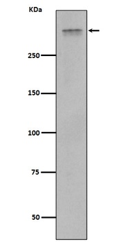 Anti-Plectin Rabbit Monoclonal Antibody