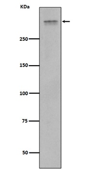 Plectin Rabbit Monoclonal Antibody