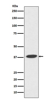 DNA Polymerase beta Monoclonal Antibody