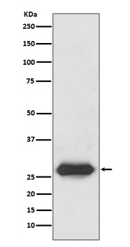 Lin28 LIN28A Rabbit Monoclonal Antibody