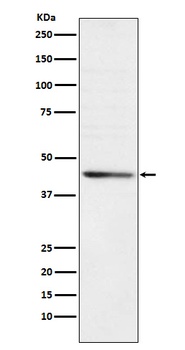 RRM2 Monoclonal Antibody