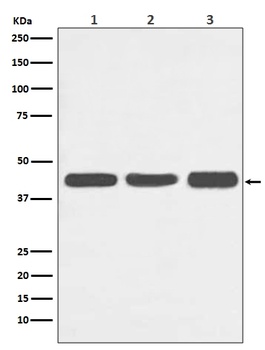 Anti-Actin ACTA1 Rabbit Monoclonal Antibody