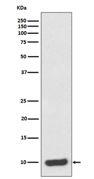 Anti-S100 alpha 6 S100A6 Rabbit Monoclonal Antibody