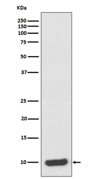 S100 alpha 6 S100A6 Rabbit Monoclonal Antibody