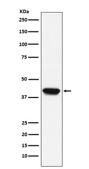 Anti-Biglycan Monoclonal Antibody