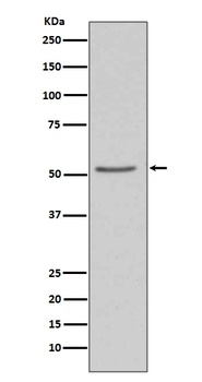 Anti-Angiotensinogen AGT Rabbit Monoclonal Antibody