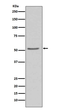 Angiotensinogen AGT Rabbit Monoclonal Antibody