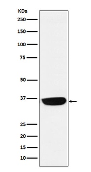 Anti-PHOX2B Monoclonal Antibody