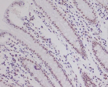 Anti-HIF-1 beta ARNT Rabbit Monoclonal Antibody