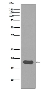 UBE2I/Ubc9 Rabbit Monoclonal Antibody