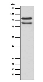 delta 1 Catenin/p120 Catenin Rabbit Monoclonal Antibody