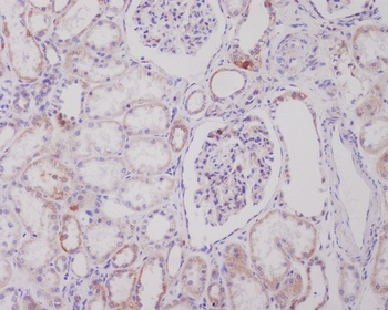 PI 3 Kinase Class 3 PIK3C3 Rabbit Monoclonal Antibody