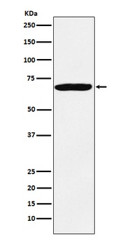 Anti-IMP3 IGF2BP3 Monoclonal Antibody