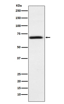 PMP70 ABCD3 Monoclonal Antibody