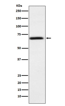 Anti-PMP70 ABCD3 Monoclonal Antibody