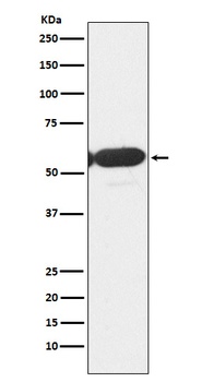 Anti-PFKFB3 Monoclonal Antibody