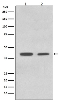 Anti-ACADM/Mcad Rabbit Monoclonal Antibody