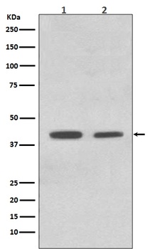 ACADM/Mcad Rabbit Monoclonal Antibody