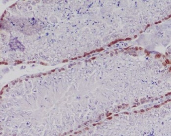 Anti-Caspase-2 CASP2 Rabbit Monoclonal Antibody