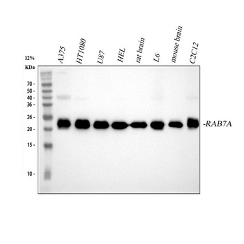 RAB7 RAB7A Rabbit Monoclonal Antibody