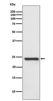 HSPB8/HSP22 Rabbit Monoclonal Antibody