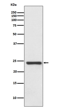 Anti-HSPB8/HSP22 Rabbit Monoclonal Antibody