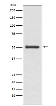 LOXL2 Rabbit Monoclonal Antibody