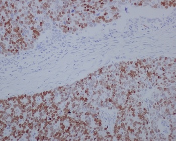 Anti-SATB2 Rabbit Monoclonal Antibody