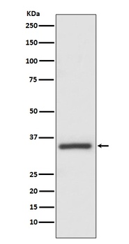 Anti-Caspase-6 CASP6 Rabbit Monoclonal Antibody