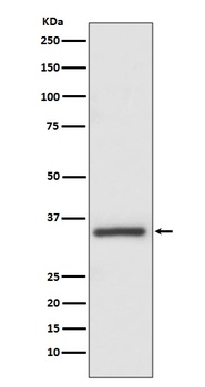 Caspase-6 CASP6 Rabbit Monoclonal Antibody